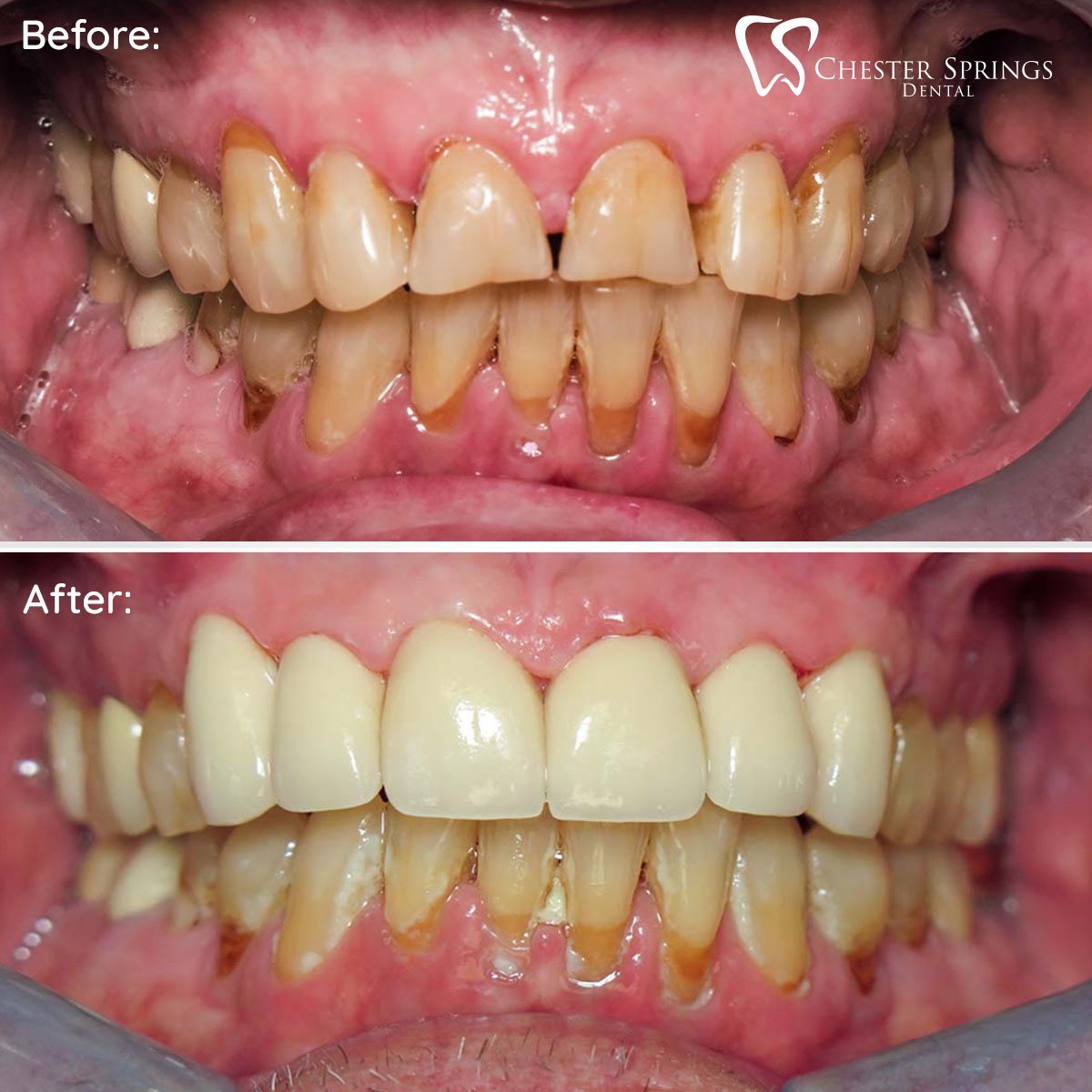 An Overview of Toothaches Chester Springs Dental Exton, PA