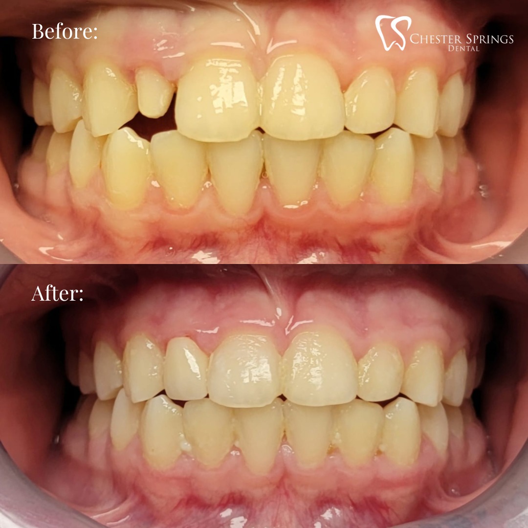 Office Gallery Chester Springs Dental Exton, PA