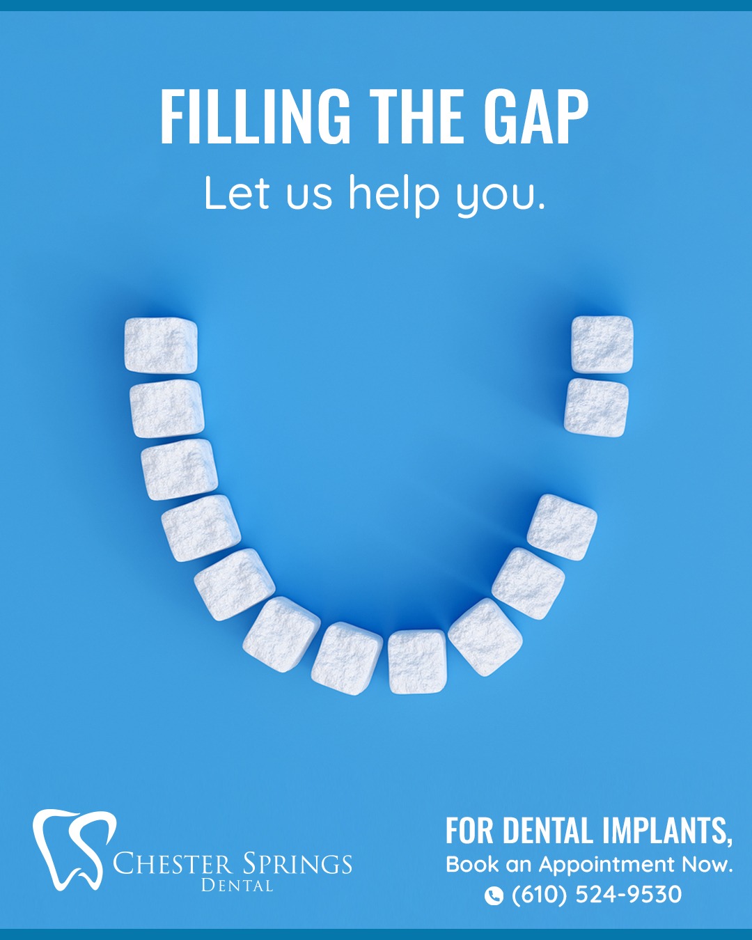 Not sure what to do about missing teeth? Tooth loss can affect both your health and your confidence. At Chester Springs Dental, we offer many options to restore your smile, boost your confidence, and improve your oral health. Schedule a consultation today! Call us at 610.524.9530.
#DentalImplants #SmileRestoration #ExtonDentists #Veneers #Crowns #ChesterSpringsDental #DentalCare